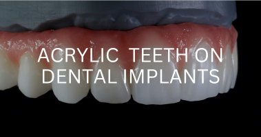 ACRYLIC TEETH ON DENTAL IMPLANTS