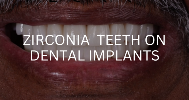 ZIRCONIA TEETH ON DENTAL IMPLANTS 1